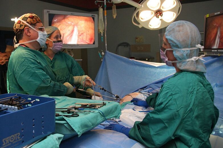chirurgie de la prostatite